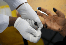 Blood is taken from a patient for an HIV test
